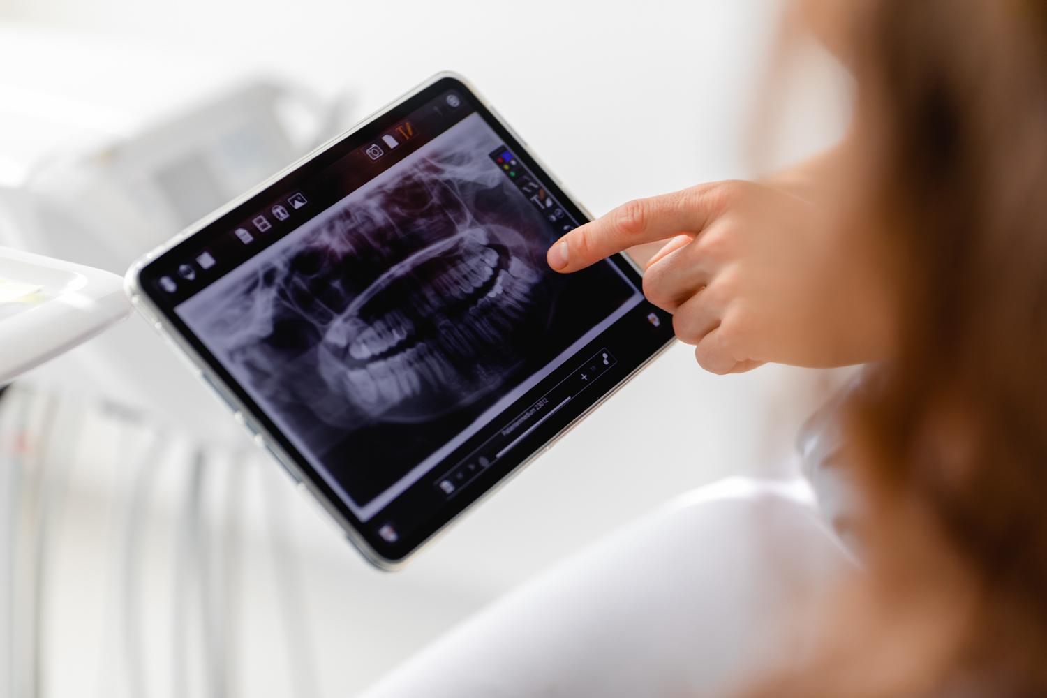 Röntgenbild auf einem iPad
